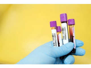 Book Malaria Antigen Blood Test in Delhi