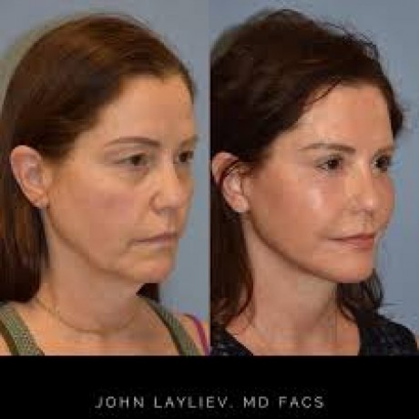 top-cosmetic-surgery-center-long-island-big-0