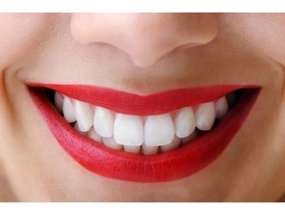 Best Teeth Cleaning in Huntington Beach, CA
