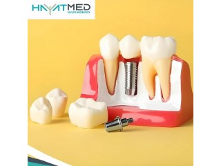 Best Dental Implants in Turkey