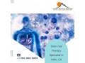 stem-cell-therapy-specialist-in-indio-ca-small-0