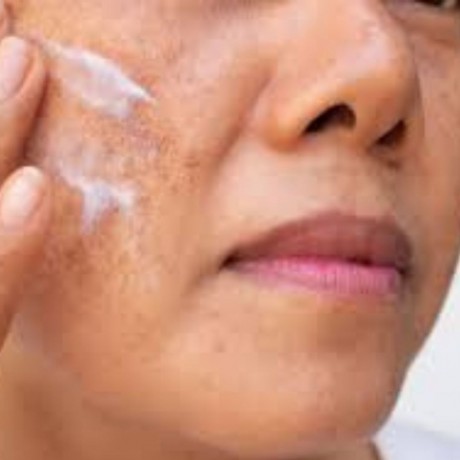 radiant-beauty-awaits-discover-melalite-forte-cream-with-hydroquinone-1mgstore-big-0