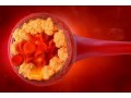 atorvastatin-generic-your-key-to-heart-health-and-beyond-small-0