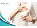 breast-augmentation-in-turkey-small-0