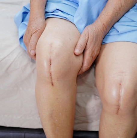 back-pain-physical-therapy-in-edgewaterr-big-0